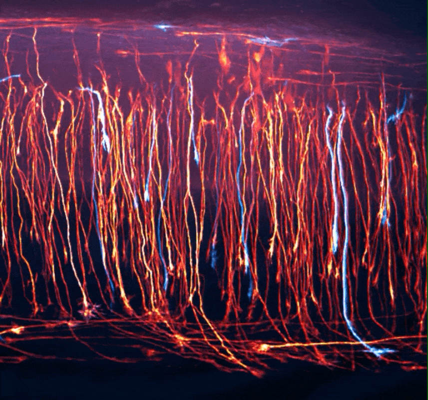 neurons_forming